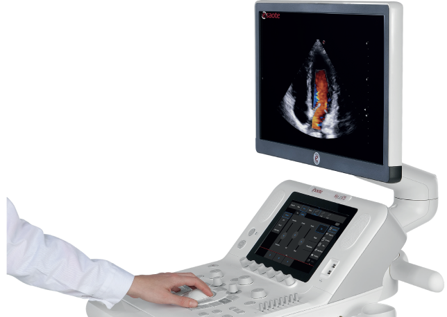 Discover Our New MyLabX75 Ultrasound System Esaote